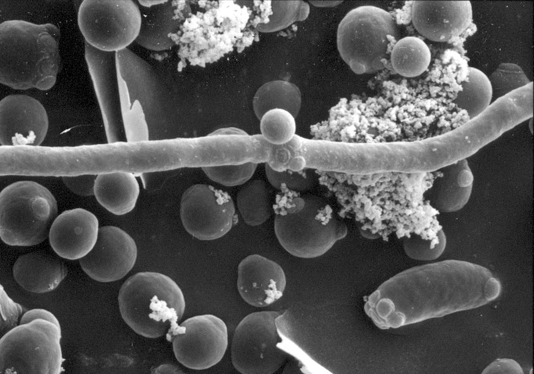 2281-SEM-2397-1363-C-albicans.png